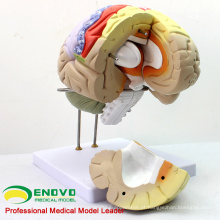 BRAIN08 (12406) Uso Médico Avançado 2X Modelo Anatômico em Tamanho Real do Cérebro em 4 Partes, Modelos de Anatomia&gt; Modelos Cerebrais